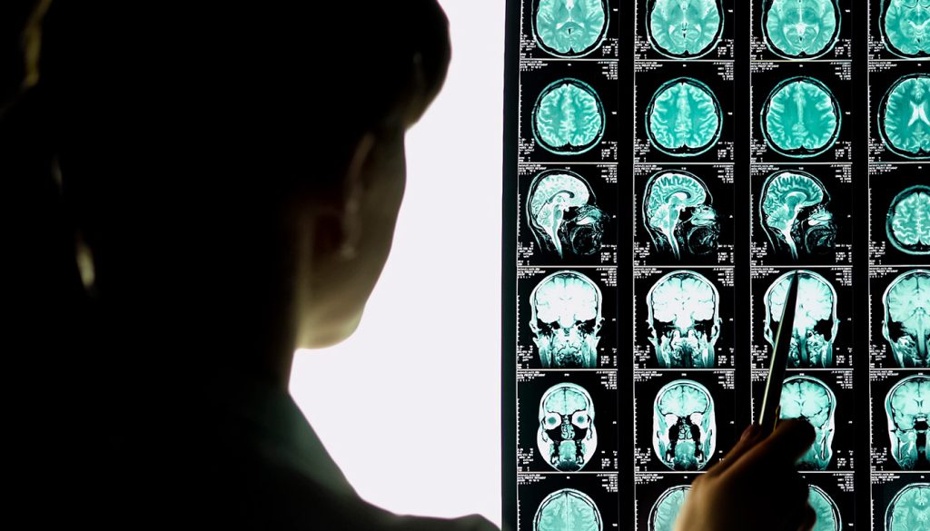 découvrez les différences de salaire des neurochirurgiens en secteur public, privé et à l’international, et comprenez les facteurs qui influencent leur rémunération.