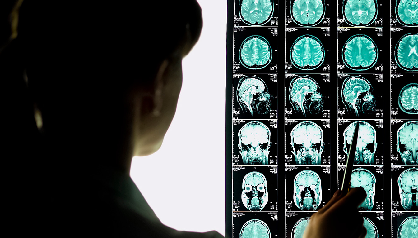 découvrez les différences de salaire des neurochirurgiens en secteur public, privé et à l’international, et comprenez les facteurs qui influencent leur rémunération.